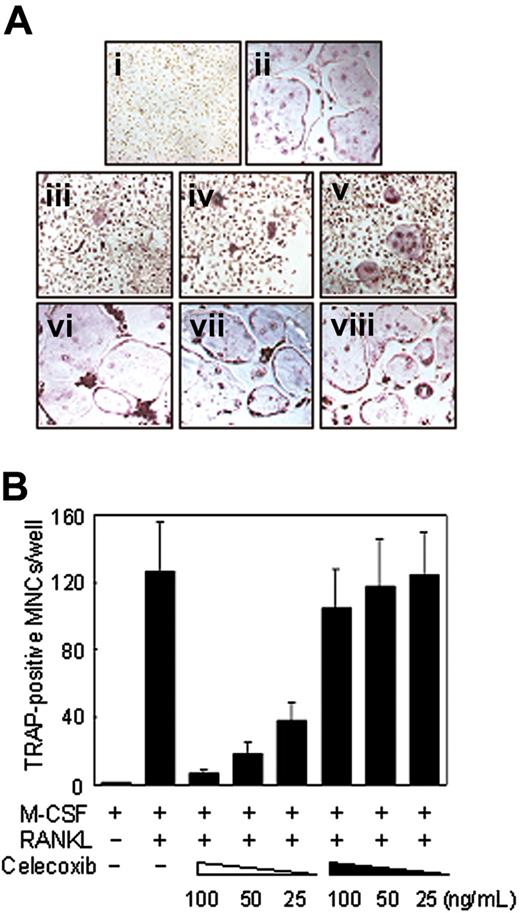 Figure 6. Suppressive effects of COX-2 inhibitor, celecoxib, on RANKL-induced osteoclastogenesis in BMMs. (A) Demonstration of TRAP+ cells differentiating from BMMs unstimulated (i) or stimulated (ii) with RANKL. On day 5 with RANKL stimulation, the cells were fixed and stained for TRAP. TRAP+ cells appear as red cells. (iii-viii) Dose-dependent effects of celecoxib on the formation of TRAP+ multinucleated osteoclasts (MNCs) with RANKL stimulation. BMMs were pretreated (iii, 100 ng/mL; iv, 50 ng/mL; v, 25 ng/mL) with different concentrations of celecoxib or treated (vi, 100 ng/mL; vii, 50 ng/mL; viii, 25 ng/mL) 2 days after RANKL stimulation. On day 5 with RANKL stimulation, the cells were fixed and stained for TRAP (original magnification, × 100). (B) Total numbers of TRAP+ MNCs are shown. Note that formation of TRAP+ MNCs was inhibited by pretreatment of celecoxib in a dose-dependent manner. The open and filled arrowheads at bottom indicate pretreatment and posttreatment with celecoxib, respectively. Similar results were obtained in 2 additional experiments. Data are expressed as means ± SDs of triplicates.