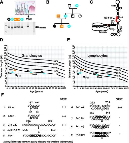 Figure 2. Molecular analysis and telomere length in a family with hTERC mutations. (A) Sequence and PCR analysis of the hTERC gene in patient F17 and family members F43, M44, M14, and F10. The 37A>G substitution is shown in yellow and the nucleotide (nt) 216 to 229 deletions are shown in blue. The presence of both abnormalities is represented by the black symbol. (B) Family pedigree showing inheritance of variant TERC genes (color codes as in panel A). Numbers indicate the ages of the individuals at the time of enrollment into the study. Question marks indicate the absence of clinical information for these individuals. (C) Cartoon illustration of the 2 sequence variants detected in this study (37A>G and 216_229del) relative to the predicted secondary structure of the human telomerase RNA (TERC), based on the phylogenetic analysis of more than 30 different vertebrate TERC RNA sequences (adapted from Chen et al21). The predicted paired (P1 and P4.1) and junctional regions (J4/4.1) are indicated. (D-E) Telomere-length measurements of the granulocytes (D) and lymphocytes (E) from the individual family members are shown relative to those (curves) of individuals in the general population to have the expected telomere lengths at certain ages (curves are based on a study of 392 control individuals; G. Baerlocher and P.M.L., unpublished data). (F) Diagram showing wild-type and mutant TERC RNA vector sequences used in this study. Note the adenine to guanine substitution at position 37 should still allow for “wobble” base-pairing interaction with its uracil base at position 187. Deletion of nucleotides 216 to 229 in the unpaired region of the RNA is shown by the dashed line. Replacements of primary sequences with complementary sequences are shown in bold.