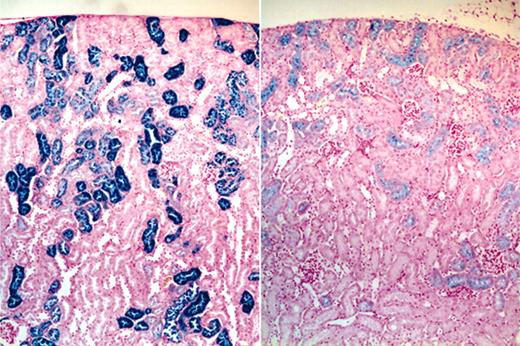 Figure 5. Effects of CLT administration on 4.1-/- mice renal tubular iron accumulation. Micrographs (original magnification, 40 ×) of iron-stained kidney sections of vehicle (left) and CLT-treated (right) 4.1-/- animals demonstrating diminished iron staining in the drug-treated group.