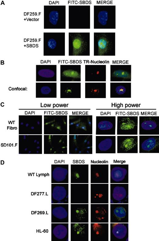 Figure 2. SBDS localizes to the nucleolus. (A) Retroviral SBDS transduction restores SBDS expression by immunofluorescence. DF259.F fibroblasts infected with retrovirus containing empty vector (top) or SBDS cDNA (bottom) were fixed and probed with the anti-SBDS antibody followed by a FITC-labeled secondary antibody. The cells were counterstained with DAPI (4′, 6-diamino-2-phenylindole) to visualize the nuclei. SBDS was located throughout the cell but was particularly prominent in the region corresponding to the nucleolus. (B) Endogenous SBDS localizes to the nucleolus. HeLa cells were fixed and probed with both an anti-SBDS polyclonal antibody and an antinucleolin monoclonal antibody. SBDS was detected with an antirabbit FITC-labeled secondary antibody, and nucleolin was detected with an antimouse Texas-Red (TR) secondary antibody. Cells were visualized by standard fluorescence microscopy (top) or by confocal microscopy (bottom). (C) SBDS nucleolar localization is intact in SD101 fibroblasts. WT control fibroblasts (NMF-100) or SD101.F fibroblasts were analyzed by immunofluorescence for SBDS. Low power, × 63 magnification; high power, × 100 magnification. (D) SBDS localizes to the nucleolus in DF269 lymphoblasts and in myeloid cells. The indicated lymphoblast cell lines or the myeloid leukemia HL-60 cell lines were subjected to immunofluorescent staining for SBDS protein and nucleolin. Nuclei were counterstained with DAPI.