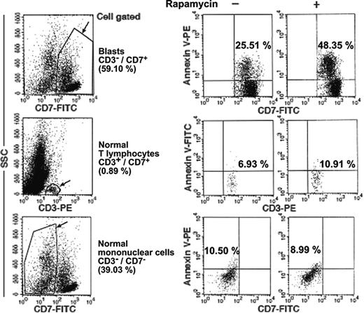 Figure 2. Normal bone marrow mononuclear cells display low sensitivity to cell-death stimuli compared with blasts. Flow cytometry evaluation of apoptosis of leukemic (CD3-/CD7+) or normal (CD3+/CD7+, CD3-/CD7-) mononuclear-cell populations (patient 8), incubated for 24 hours with 25 ng/mL rapamycin. The cells were gated on the basis of FL1 (CD7-FITC)/side scatter (SSc) or FL2(CD3-PE)/SSc parameters and the percentage of annexin-positive cells was measured.