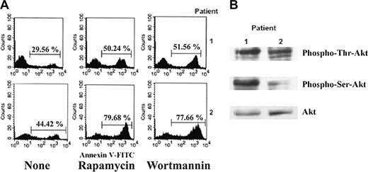 Figure 3. The PI3k/Akt pathway plays a role in ALL blast apoptosis. (A) Flow cytometry analysis of apoptosis, by annexin V-FITC staining, of ALL blasts incubated for 24 hours with and without rapamycin (100 ng/mL) or wortmannin (1 μM). The percentages over the bars indicate the amount of annexin V-positive cells. (B) Western blotting assay of phospho-Akt, at Ser 473 or Thr 308, in cell lysates from the same samples.