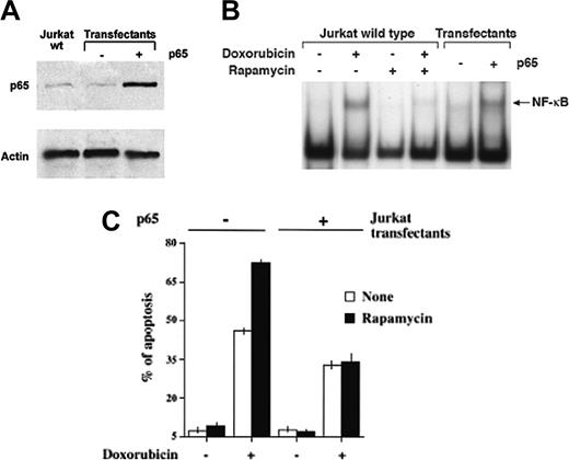 Figure 6. Rapamycin does not enhance doxorubicin-induced apoptosis in RelA-hyperexpressing transfectants. (A) Western blotting analysis of p65 (RelA) expression levels in cell lysates obtained from wild-type Jurkat cells and void vector- or RelA-stable transfectants. (B) EMSA analysis of nuclear extracts obtained from Jurkat wild-type cells cultured for 5 hours with and without 5 μM doxorubicin and with or without rapamycin (100 ng/mL), and RelA- or void vector-stable transfectants. (C) Analysis of apoptosis of RelA- or void vector-stable transfectants cultured with and without 5 μM doxorubicin and with and without rapamycin (100 ng/mL). After 24 hours of incubation, cells were harvested and cell death was analyzed by propidium iodide incorporation in flow cytometry. Results are from 4 different experiments, each of which was in triplicate. Error bars indicate standard deviations.