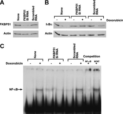 Figure 7. FKBP51 controls drug-induced NF-κB activaton in human leukemia. (A) Western blotting analysis of FKBP51 expression levels in cell lysates obtained from transfected or nontransfected Jurkat cells, with FKBP51 siRNA or the scrambled oligo as control. (B) Western blotting analysis of IκBα expression levels in cells transfected with FKBP51 siRNA and cultured with or without doxorubicin (5 μM) for 5 hours. (C) EMSA analysis of nuclear extracts from Jurkat cells transfected with FKBP51 siRNA and cultured with or without doxorubicin (5 μM) for 5 hours. A competition assay, with the same -κB cold oligo or an unrelated oligo (see “Materials and methods”), indicated the specificity of the NF-κB band.