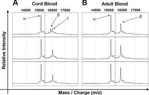 Figure 5. SELDI-TOF-MS analyses of red blood cell lysates. Globin proteins detected in erythrocytes from 3 cord blood (A) and adult blood (B) samples are displayed in the 14 000-Da to 17 000-Da mass range (top of each panel). Arrows indicate the α-, β-, and γ-globin proteins. Dotted lines indicate the expected location of μ-globin if it were present.