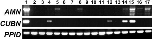 Figure 1. Tissue expression AMN and CUBN cDNA. Total RNA isolated from the designated tissues was amplified by RT-PCR. AMN primers were designed to amplify the full-length coding sequence (product size 1.4 kbp). CUBN primers amplified exons 8-12 (product size 0.5 kbp). PPID primers were used as a positive control for success of the RT reaction in each RNA sample (product size 0.6 kbp). Lanes: 1, kidney; 2, muscle; 3, spleen; 4, thymus; 5, liver; 6, heart; 7, lung; 8, pituitary; 9, testis; 10, cerebellum; 11, cerebrum; 12, placenta; 13, duodenum; 14, jejunum; 15, ileum; 16, colon; 17, pancreas.