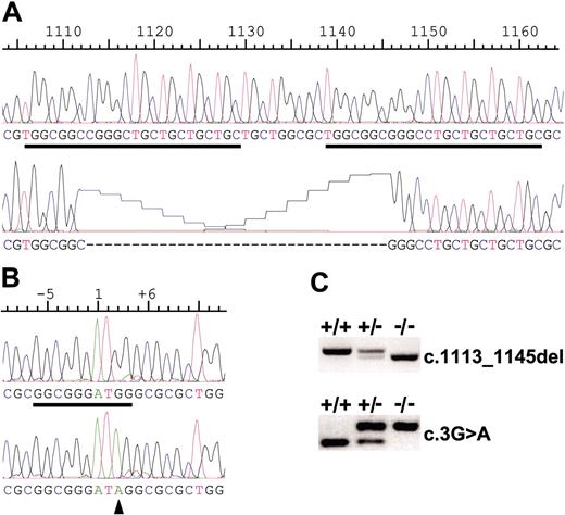 Figure 3. AMN mutations in canine I-GS. (A) Normal canine AMN cDNA sequence in exon 10 (above) and the corresponding c.1113_1145del mutation sequence of the GS kindred disease allele (below) are shown. Two copies of a near-perfect 24-bp repeat (underlined) apparently predisposed this locus to deletion by unequal crossover. (B) Normal canine AMN cDNA sequence in exon 1 (above) and the corresponding c.3G>A mutation sequence (arrowhead) of the AS kindred disease allele (below) are shown. The putative translation initiation site of the normal sequence is underlined and conforms to the Kozak consensus. (C) Representative mutation screening tests performed with gDNA templates are shown.