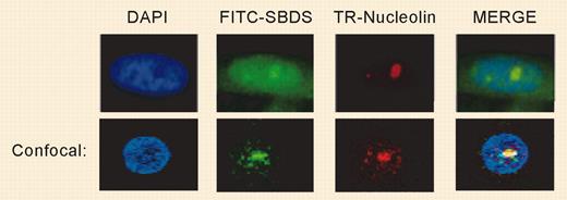 SBDS localizes to the nucleolus. See the complete figure in the article beginning on page 1253.