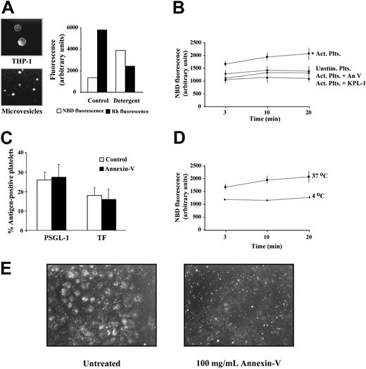 Figure 4. Microvesicles fuse with activated platelets. (A) Fluorescence microscopy (NBD channel) of THP-1 cells labeled with NBD-PE and Rh-PE (left panel, top) and of their shed microvesicles (left panel, bottom). Original magnifications, × 40 and × 400 on a Nikon Eclipse EP00 upright microscope equipped with 4 ×/0.13 NA and 40 ×/0.75 NA objective lenses (Nikon, Melville, NY), respectively. Images were captured using a Photometrics CoolSnap CS digital camera (Photometrics, Tucson, AZ). Solubilization of the labeled microvesicles with 1% SDS diluted the probes, resulted in an increase in NBD fluorescence, and a decrease in Rh fluorescence (right panel). (B) Labeled microvesicles were incubated with either: (x) unstimulated platelets; (▪) activated platelets; (♦) activated platelets + annexin V (100 μg/mL); (▴) activated platelets + anti–PSGL-1 antibody, KPL-1 (5 μg/mL). (C) Transfer of PSGL-1 and TF to activated platelets by monocyte microvesicles, as assessed by flow cytometry. Annexin V (100 μg/mL) did not affect the number of platelets that acquire these proteins. Background fluorescence was determined using fluorescent nonspecific mouse IgG. n = 3. (D) Membrane fusion between activated platelets and THP-1 microvesicles at 37°C (▪), and at 4°C (▪). (E) Fluorescence microscopy in rhodamine channel (×40) showing the transfer of the fluorescent lipid R18 from labeled microvesicles to platelets adhered on immobilized fibrinogen. Transfer of the lipid resulted in the spread platelets becoming fluorescent, an effect that was blocked by annexin V. The small fluorescent spots in the annexin V–treated sample correspond to the labeled microvesicles. These images are representative of 4 experiments. Act indicates activated; Plts, platelets; Unstim, unstimulated; An V, annexin V. Error bars indicate ± standard deviation (SD) in panels B-D.