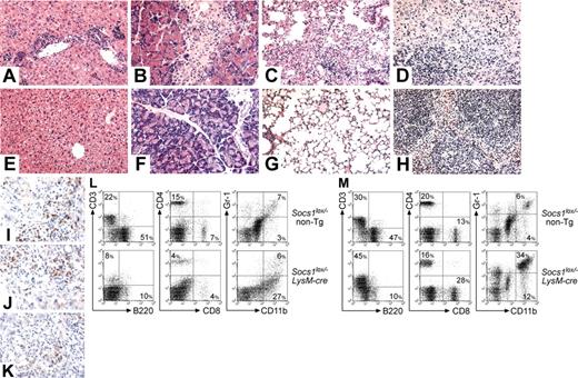 Figure 2. Socs1lox/- LysM-cre mice succumb to a multiorgan inflammatory disease. Representative hematoxylin and eosin-stained sections of the (A,E) liver, (B,F) pancreas, (C,G) lung, and (D,H) spleen from (A-D) moribund Socs1lox/- LysM-cre mice and (E-H) healthy Socs1lox/- nontransgenic littermates. Frozen sections of liver from moribund Socs1lox/- LysM-cre mice were stained with antibodies recognizing (I) CD4, (J) CD8, and (K) CD11b. (L) Splenocytes and (M) blood leukocytes from moribund Socs1lox/- LysM-cre and age-matched Socs1lox/- nontransgenic mice were analyzed for expression of the indicated markers by flow cytometry. Quadrant percentages are shown.