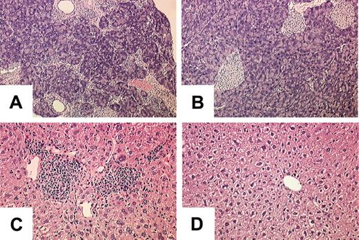 Figure 6. The Socs1lox/- LysM-cre inflammatory disease can be transferred to wild-type recipients by BM transplantation. Lethally irradiated C57BL/6 recipients received transplants of BM from (A,C) Socs1lox/- LysM-cre or (B,D) Socs1lox/- nontransgenic donors. Organs were harvested for analysis 3 months after transplantation. Shown are the (A-B) pancreas and (C-D) liver.