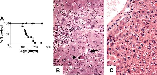 Figure 7. Targeting SOCS-1 deficiency to hepatocytes exacerbates the hepatocyte damage in Socs1lox/- LysM-cre mice. (A) Survival curves of Socs1lox/- Alb-cre (▴; n = 6), Socs1lox/- Alb-cre/LysM-cre (▪; n = 14), and Socs1lox/- Alb-cre/Lck-cre (•; n = 6) mice. (B) Liver pathology in Socs1lox/- Alb-cre/LysM-cre mice compared with (C) Socs1lox/- Alb-cre mice. Note the swelling of hepatocytes that is not seen in Socs1lox/- LysM-cre mice (Figure 2A). Collapsed hepatocytes (*) and vacuole formation within hepatocytes (arrow) are also readily identifiable.