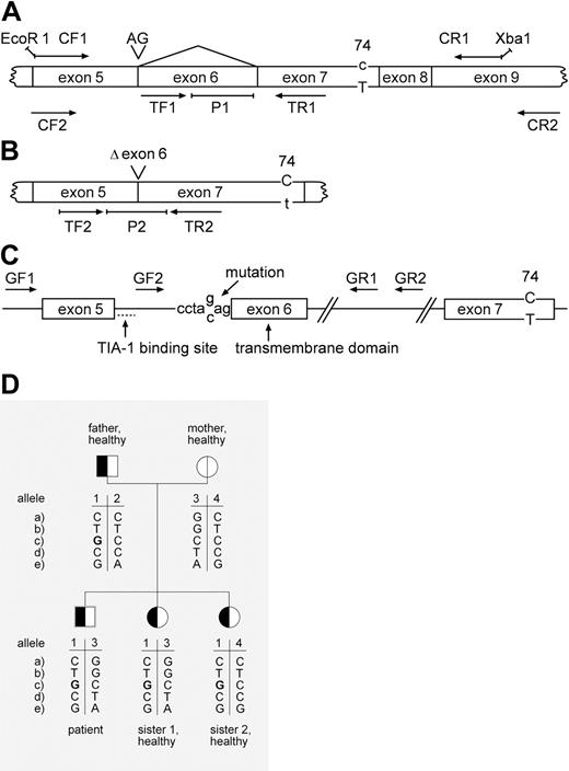Figure 1. Positions of primers and probes in the CD95 genomic and cDNA, and overview of important sequences in the patient with ALPS. (A) cDNA, including exon 6. There is an AG insert in a few strands that is linked to a C in the polymorphic position 74 (position 74 downstream of the 5′ end of exon 7, same as position 836 bp downstream of the first translated ATG). Most normally spliced cDNA (including exon 6, but not the extra AG) has a T in position 74. Primers CF1 and CR1 were used for cloning; CF2 and CR2 for RT-PCR; and TF1, P1, and TR1 for TaqMan PCR to quantify the normally spliced form. (B) Splice forms that lack exon 6 and hence the transmembrane domain. They mostly have a C in position 74. These forms were quantified by TaqMan PCR using TF2, P2, and TR2. (C) Genomic sequence with a mutation C→G in position –3 upstream of exon 6 on one allele and with the C/T polymorphism in exon 7. The primers used for genomic sequencing (GF1, GF2, GR1, GR2), the TIA-1 binding site, and the transmembrane domain are marked. (D) Pedigree and SNP haplotyping. Analysis of intronic SNPs upstream of exon 5 (a, b) and downstream of exon 7 (e), the C/T SNP expressed in exon 7 (d) 836 bp downstream of the first translated ATG (see position 74 A, B, C, also used in Table 2), and the mutation ex-6–3C→G (c), which is associated with excessive sFas production, decreased mFas expression, and apoptosis (Figures 2 and 4).
