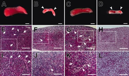Figure 1. Macroscopic and microscopic characterization of the spleens of M33- and Ad4BP/SF1-KO mice. Wild-type (A), M33-KO (B), SCID mouse (C), and Ad4BP/SF1-KO (D) spleens at 18.5 days after coitus are compared macroscopically. White arrowheads (B,D) indicate red spots characteristic of the M33- and Ad4BP/SF1-KO spleens. Stereomicroscopic images (A-D) were photographed with a Leica MZ APO (Leica, Wetzlar, Germany) using Photograb imaging solution (Fujifilm) and a Fuji HC-500 digital camera. Images were processed with Adobe Photoshop. Splenic tissue from wild-type (E,I), M33-KO (F,J), SCID mouse (G,K), and Ad4BP/SF1-KO (H,L) fetuses at 18.5 days after coitus were sectioned and stained with hematoxylin and eosin for microscopic observation. White arrows indicate assembled vascular structures. White arrowheads in panel E indicate hematoxylin-stained cells around the vasculatures. Scale bar, 800 μm (A-D), 100 μm (E-H), and 50 μm (I-L).