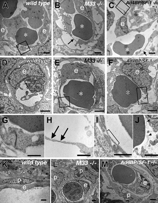 Figure 2. Defects in endothelial cells of M33-KO spleens. Vessel structures of wild-type (A,D,K), M33-KO (B,E,L), and Ad4BP/SF1-KO (C,F,M) spleens at 16.5 days after coitus were observed by electron microscopy. Boxed areas in panels A, C, E, and F are enlarged in G, H, I, and J, respectively. Arrows (B,C,H) and a square bracket (I) indicate extremely thin (∼ 30 nm) regions of the endothelial cells in the M33- and Ad4BP/SF1-KO spleens. Arrowheads (J) show collagen fibers. * indicates red blood cell; e, endothelial cell. Scale bar, 1 μm (A-F and K-M), 500 nm (G-J). Original magnification, 6000 × (A), 5000 × (B,D,E), 3500 × (C,K), 5000 × (D,E), 4000 × (F,L,M), 8000 × (G), and 10 000 × (H-J).