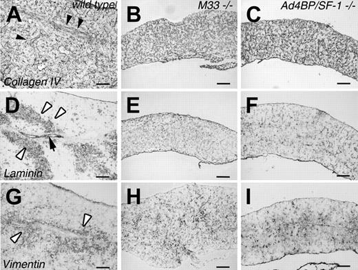Figure 3. Immunohistochemical analysis of M33-KO spleens. The expression of marker proteins was compared among wild-type (A,D,G), M33-KO (B,E,H), and Ad4BP/SF1-KO (C,F,I) spleens at 18.5 days after coitus. Frozen sections were stained with antibodies against type-IV collagen (A-C), laminin (D-F), and vimentin (G-I). Closed arrowheads indicate trabeculae. An arrow indicates a vascular structure. Open arrowheads indicate cells assembled around the vascular structures. Scale bar, 100 μm.
