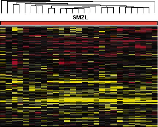 Figure 1. Hierarchical clustering of SMZL series, demonstrating the relative homogeneity of this series, which appears clustered into a single group. Red and green indicate high- and low-level expression, respectively.