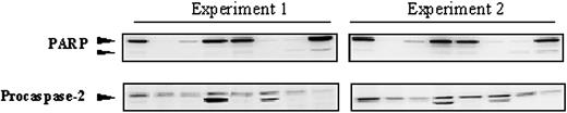 Figure 2. Reproducibility of PARP and procaspase-2 protein detection in childhood acute leukemia samples. Representative Western blots from 2 independent experiments incubated with monoclonal anti-PARP or anti-procaspase-2 antibodies are depicted.