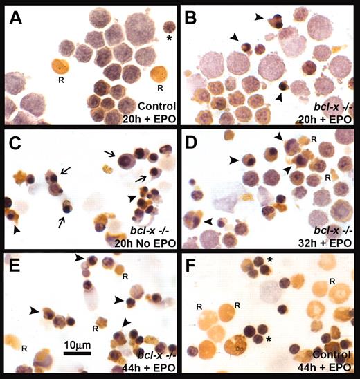 Figure 4. Morphologic appearance of cultured bcl-x-/- and bled control erythroblasts. Cytospin preparations of erythroblasts harvested at various times were stained with 3,3′-dimethoxybenzidine and hematoxylin and examined by light microscopy. (A) Bled control erythroblasts cultured with EPO for 20 hours. (B) bcl-x-/- erythroblasts cultured with EPO for 20 hours. (C) bcl-x-/- erythroblasts cultured without EPO for 20 hours. (D) bcl-x-/- erythroblasts cultured with EPO for 32 hours. (E) bcl-x-/- erythroblasts cultured with EPO for 44 hours. (F) Bled control erythroblasts cultured with EPO for 44 hours. Arrowheads indicate examples of apoptotic, benzidine-positive, mature cells that have accumulated hemoglobin; arrows indicate examples of apoptotic, benzidine-negative, immature cells that have not accumulated hemoglobin; asterisks indicate examples of extruded nuclei; and R indicates an example of a reticulocyte. Original magnification, × 560.