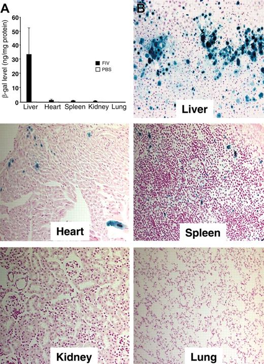 Figure 1. Tissue transduction. (A) Tissue distribution of βgal expression 3 weeks following delivery of 2.4 × 108 TU GP64/CMV-βgal. Control animals received injection of PBS (7 β-gal; 3 PBS). Error bars indicate mean ± SEM. (B) Localization of βgal expression in tissues (magnification, 20×). One-month-old mice were injected via tail vein over 2 consecutive days with 2.4 × 108 TU GP64/CMV-βgal. Three weeks after injection, the mice were killed and organs (liver, heart, spleen, kidney, and lung) harvested and X-gal stained.