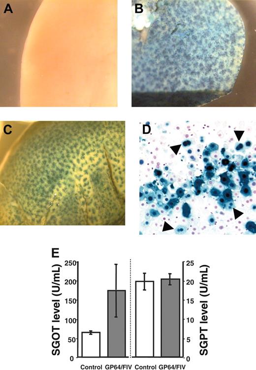 Figure 2. Liver staining. One-month-old mice received either control buffer (A) or GP64/CMV-βgal vector (B-C). Three weeks after injection, livers were X-gal stained and examined under stereomicroscopy (2 representative mice from 3 separate sets of experiments from 15 experimental and 8 control animals are shown). (D) Liver tissue section. Most of the nuclear-targeted β-gal–positive cells were hepatocytes. In some cases 2 neighboring cells had blue nuclei (arrowheads), suggesting clonal expansion. (E) Plasma SGOT (left) and SGPT (right) levels at 24 hours after injection with PBS or FIV vector (5 experimental and 3 control mice, mean ± SE).
