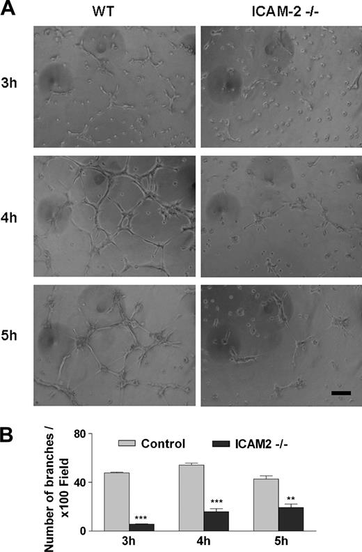 Figure 1. ICAM-2 mediates angiogenesis in vitro: tube formation on Matrigel. (A) Primary murine cardiac endothelial cells (MCECs) isolated from control (WT) or ICAM-2–/– mice were seeded on Matrigel. In each experiment, 6 age- and sex-matched mice/group were used. The figure shows 1 representative of 3 separate experiments, each performed in triplicate. Left panels show WT; right panels, ICAM-2–/–. In WT, cells were spreading, elongating, and making contacts with neighboring cells at 3 hours, and an interconnecting tube network was formed over 4 to 5 hours. At all time points studied, the branches and tubes formed by ICAM-2–/– cells were much less developed compared with control. Scale bar equals 100 μm. Images were acquired using a Leitz Labovert inverted microscope (Leica Microsystems, Milton Keynes, United Kingdom) fitted with a 10 × phase-contrast objective lens (Leitz-Phaco 10 ×/0.25 NA). Images were captured with a digital camera model DP50-CU (Olympus) using Viewfinder Lite (v. 1) software (Olympus). Image processing was carried out using Adobe Photoshop CS (Adobe Systems). (B) Branches from each cell were counted from 3 representative 100 × field/well. Error bars indicate mean ± SEM. **P < .01; ***P < .001 analysis of variance (ANOVA).