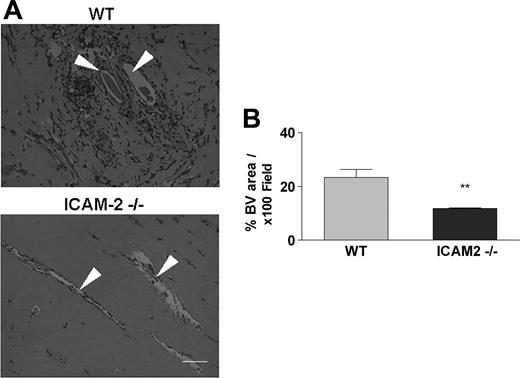 Figure 2. ICAM-2 mediates angiogenesis in vivo: Matrigel plug assay. Matrigel plugs were generated by subcutaneous injection of Matrigel; the plugs were removed 7 days later and processed for H&E staining. (A) In samples from WT mice (top), formation of vascular structures within the plugs is accompanied by erythrocyte and leukocyte infiltration. In samples from ICAM-2–/– mice (bottom) a significant reduction in vascular structures and cellular infiltration within the plugs was observed. Arrowheads show blood vessels. Scale bar equals 100 μm. Images were acquired as in Figure 1A. (B) The vascular lumen area was measured using Image ProPlus software. The average vessel-containing area was calculated from 5 representative 100 × fields of 3 representative serial sections of each plug and is shown as the percentage of area occupied by blood vessel (BV)/100 × field. Compared with WT mice, a 50% reduction in vessel-containing areas were observed in samples from ICAM-2–/– mice. Data represent 1 of 2 independent experiments; 5 to 6 mice per group were used in each experiment. Error bars indicate mean ± SEM. **P < .01, unpaired t test.