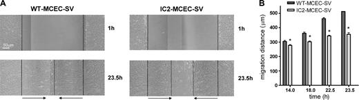 Figure 6. ICAM-2 is involved in endothelial-cell migration. WT-MCEC-SV and IC2-MCEC-SV cells were used in a wound-healing assay. Confluent monolayers were scratch-wounded and incubated for up to 48 hours. (A) Photographs of wounded monolayers taken at 1 and 23.5 hours. The vertical lines indicate the wound edge and the migration front (dotted line). The horizontal arrows indicate the migration distance. Scale bar equals 50 μm. Images were acquired as in Figure 1A. (B) Migration distance, measured at 14, 18, 22.5, and 23.5 hours. IC2-MCEC-SVs show decreased migration at all time points, compared with WT. Values represent mean ± SD of 8 measurements. *P < .001, unpaired t test.