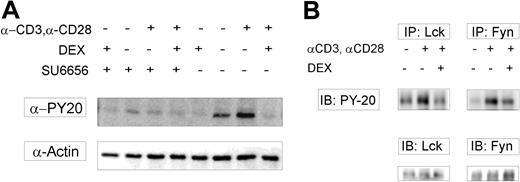 Figure 3. DEX inhibits Lck and Fyn kinase activity in vitro. (A) CD4+ cells were pretreated with a specific Src family kinase inhibitor (SU6656) for 45 minutes and subsequently incubated with DEX or DMSO supplemented media (control) for 10 minutes and activated with anti-CD3 and anti-CD28 Abs for 15 minutes. In vitro kinase assays were performed using SAM68 as a substrate, and Src-like kinase activity was analyzed on Western blot using PY20. Equal loading was evaluated with an Ab against actin. Phospho-SAM68 expression is observed upon TCR ligation. Incubation with SU6656 resulted in abrogation of SAM68 phosphorylation, and a similar effect was demonstrated in activated cells treated with DEX. (B) Lysates of CD4+ cells, pretreated with DEX (10 minutes) and subsequently activated (15 minutes), were subjected to Lck and Fyn immunoprecipitation, followed by in vitro kinase assay. To test for equal loading, Western blots were analyzed for total Lck and Fyn expression. Reduced phospho-SAM68 expression was seen in activated cells incubated with DEX, compared with cells incubated in the absence of DEX. Similar results were obtained in 3 independent experiments. DEX indicates dexamethasone; IB, immunoblotting; IP, immunoprecipitation.