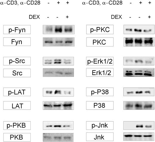 Figure 4. DEX inhibits signaling pathways downstream of the TCR. Cells were preincubated for 10 minutes with or without DEX and subsequently stimulated for 15 minutes using anti-CD3 and anti-CD28 Abs. The phosphorylation status of Fyn, Src, LAT, PKB, PKC, p38, ERK1/2, and JNK in whole-cell lysates was assayed using phosphospecific mAbs on Western blot. An Ab against phosphorylated Lck associated with increased activity (not available) was not included.48 The Ab we used to detect phosphorylated Src may cross-react with other Src kinase family members, including Fyn, Lck, Lyn, pp62c-yes (Yes), hematopoietic cellular kinase (Hck), and Src itself when phosphorylated at equivalent sites. Therefore, we cannot exclude the possibility that suppressed Src phosphorylation represents reduced phosphorylation of Src itself or other Src family members. To test for equal loading Western blots were stripped and reprobed using the appropriate Abs. The Western blots represent 3 independent experiments. LAT indicates linker for activation of T cells; PKC, protein kinase C; PKB, protein kinase B; DEX, dexamethasone.