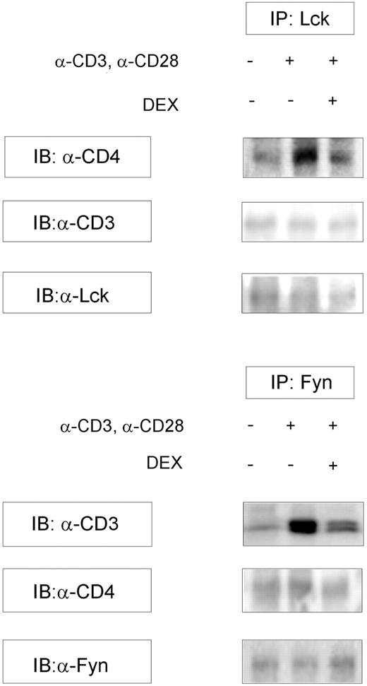 Figure 5. DEX affects Lck-CD4 and Fyn-CD3 associations. Cells were preincubated with DEX for 10 minutes and subsequently stimulated with anti-CD3/anti-CD28 Abs for 15 minutes. Lck and Fyn were then immunoprecipitated, and samples were analyzed for CD4 and CD3 expression on Western blot. To test for equal loading, blots were analyzed for total Lck and Fyn expression. Upon TCR ligation, CD4 and CD3 expression is increased in Lck and Fyn immunoprecipitates, respectively. Reduced CD4 expression was observed in Lck immunoprecipitates prepared from activated cells treated with DEX. Similarly, Fyn-immunoprecipitated lysates demonstrated decreased CD3 protein levels upon DEX treatment. CD3 expression was analyzed in Lck immunoprecipitates, and CD4 protein levels were studied in Fyn immunoprecipitates to ensure specificity in this experiment. Three experiments were performed and comparable results were obtained. DEX indicates dexamethasone; IB, immunoblotting; IP, immunoprecipitation.