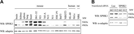 Figure 2. Expression of SPHK1 in murine, rat, and human tissues or cell lines. (A) Whole-cell lysates were subjected to Western blot analysis (WB) with antibodies directed against SPHK1 protein and α-adaptin as loading control. Among hematopoietic cell lines, IW1-32 and 745-A are erythroleukemic cell lines derived from Friend murine leukemia virus (F-MuLV)- or spleen focus-forming virus (SFFV)-induced erythroid tumor cells, 921 is an HS2 erythroleukemic cell line from spi-1-transgenic mice, N13 and N11 are macrophagic cell lines, FDC-P1 is a multipotent progenitor cell line, Ba/F3 is a pro-B-cell line, and HL-60 is a myeloblastic cell line. NIH3T3 and NRK (normal rat kidney) are fibroblastic cell lines. (B) Western blot with anti-SPHK1 antibodies of whole-cell lysates harvested 24 hours after transfection with Luc siRNA and SPHK1 siRNA. HeLa cells are epithelial cells.