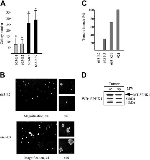 Figure 5. Overexpression of SPHK1 in HS1 cells enhances their proliferation and cloning efficiency and confers tumorigenicity. (A) Number of colonies formed by control 663-B1 and 663-B2 cells and SPHK1-transfected 663-K3 and 663-K39 cells. Five hundred cells were inoculated in semisolid medium containing 1% serum and Epo (1 U/mL) and the colonies were numbered after 8 days. The representative plotted data are shown as the average colony number (±SD) from four experiments in duplicate, determined in a doubled-blinded manner. * indicates statistical significance by Student t test: P < .005 compared with the control. (B) Colony-formation assay with control 663-B2 cells and MT-SPHK1-transfected 663-K3 cells. Images were captured as in Figure 4C, except for given magnifications. (C) Percentage of recipient mice bearing tumors after subcutaneous injection of control 663-B2 cells, SPHK1-transfected 663-K3 and 663-K39 cells, and 921 HS2 cells (7 mice/cell line). (D) Expression of the MT-SPHK1 and endogenous SPHK1 in the subcutaneous (sc) and spleen tumor (sp) isolated in the same nude mice grafted with 663-K39 cells was analyzed by Western blotting using anti-SPHK1 antibodies.