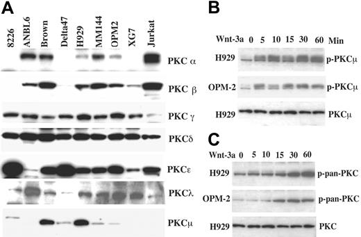 Figure 4. Expression of PKC isoforms and phosphorylation of PKCμ following Wnt-3a treatment. (A) Cell lysates from the indicated lines were resolved on 8% SDS-PAGE gels, transferred to membranes, and blotted with the indicated antibodies. Lysate from Jurkat cells was included as a control for PKC expression. (B) Myeloma cell lines starved in serum-free medium for 12 hours were treated with Wnt-3a or con-CM for the indicated time. Lysates were resolved on 8% SDS-PAGE gels, transferred to membranes, and blotted with anti-p-PKCμ (B) or anti-p-pan-PKC (C) antibodies.