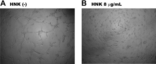 Figure 6. HNK significantly inhibited angiogenesis of HUVECs. HUVECs were cultured with (B) or without (A) 8 μg/mL HNK for 6 hours, and tube formation was assessed. Original magnification ×40.