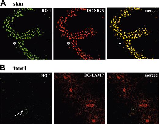 Figure 3. Detection of HO-1+ and HO-1- DCs in human tissues. (A) Confocal micrographs of cryostat sections from human skin show HO-1+ cells (green fluorescence), DC-SIGN+ cells (red fluorescence), and merged images with dual labeling. Dermal iDCs show complete overlap of HO-1 and DC-SIGN expression. The epidermis (*) shows very low or absent expression of both HO-1 and DC-SIGN. (objective, × 40/1.0). (B) Confocal micrographs of cryostat sections from a chronically infected human tonsil show few weakly HO-1+ cells (green fluorescence, arrow), DC-LAMP+ cells (red fluorescence), and merged images with dual labeling. Tonsil mature DCs expressing DC-LAMP do not express HO-1 (objective, × 63/1.4). Results are representative of 3 different skin and tonsils analyzed in the same way.