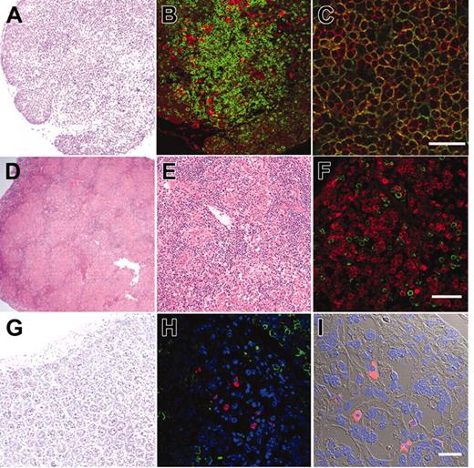 Figure 3. Histology of lymphoid organs in engrafted NOD/SCID/IL2rγnull recipients. (A) The thymus showed an increased cellularity after reconstitution. (B) The thymus stained with anti-hCD3 (green) and anti-hCD19 (red) antibodies. (C) The thymus stained with anti-hCD4 (green) and anti-hCD8 (red) antibodies. The majority of thymocytes are doubly positive for hCD4 and hCD8. (D-E) Lymphoid follicle-like structures in the spleen of a recipient. (F) The lymphoid follicles mainly contained hCD19+ B cells (red) that were surrounded by scattered hCD3+ T cells (green). (G) Histology of the intestine in an engrafted NOD/SCID/IL2rγnull recipient (left). (H) In the intestine, DAPI+ (4′,6-diamidino-2-phenylindole)–nucleated cells (blue) contained both scattered hCD3+ T cells (green) and human IgA+ cells (red). (I) The DIC image of the same section shows that IgA+ B cells were mainly found in the interstitial region of the intestinal mucosal layer. White bars inside panels represent 80 μm (C), 100μm (F), and 20μm (I).
