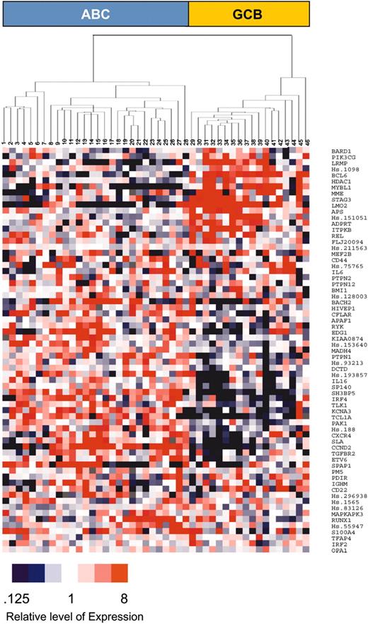Figure 2. Hierarchical clustering of 46 DLBCL cases. A total of 46 cases (22 of CD5+, 7 of CD5-CD10+, and 17 of CD5-CD10-) were clustered with the aid of Tree View software, based on the expression of 67 of 100 genes as described by Rosenwald et al.8 The degree of relative expression of the gene for each sample is indicated at the bottom. The samples were divided into 2 subgroups, ABC (left) and GCB (right).