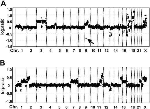 Figure 3. Typical individual genome profiles of DLBCL cases. The individual genomic profile of 2 CD5-CD10- cases, 1 with an ABC signature (A) and the other with a GCB signature (B). Chr. indicates chromosome number. (A) Genomic gains are the following: 3p26.3-q12.3, 3q13.33-q29, 4q32.1-q35.1, 9p24.3-q22.33, 17p11.2-q21.1, 17q21.32, 17q23.2-q24.2, 18q, and Xp22.11-q28; genomic losses are the following: 9p21.3 (arrow), 13q14.3-q21.2, 15q21.3, 17p11.2-p13.3, and 17q21.33-q22. Note that loss of 9p21 occurred only at BAC, RP11-149I2 (arrow), which contains p16INK4a. (B) Genomic gains are the following: 1q21.3-q44, 2p13.2-p25.1, 7, 11q13.5-q25, 15q24.3-q26.3, 16, 21q, and X; genomic losses are the following: 1p36.22-p36.33, 1p13.1-p31.2, and 13q13.1-q14.3.