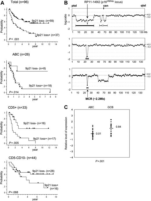 Figure 6. Genomic loss of 9p21.3, overall survival, and comparison of p16INK4a gene expression in the ABC and GCB groups. (A) Kaplan-Meier analyses of survival of total cases, ABC cases, CD5+ cases, and CD5-CD10- cases either with or without 9p21.3 (p16INK4a locus) loss. (B) Representative individual genome profile of 9p21 in 3 cases. Dots represent the log2 ratio of BAC/PAC clones, which are shown in order from the p telomere to the q telomere. Bold lines under each profile indicate regions of loss. MCR indicates minimum common region of 9p loss. Vertical lines indicate log2 ratio; horizontal lines, megabases. Threshold of log2 ratio is -0.2 < log2 ratio < +0.2. (C) Comparison of p16INK4a expression in the ABC and GCB groups. Statistical significance of the difference was calculated using the Mann-Whitney U test. Horizontal bars indicate the mean value of relative level of expression.