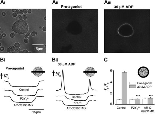Figure 1. Single-cell measurements of fibrinogen binding demonstrate functional synergy between P2Y1 and P2Y12 receptors in primary murine megakaryocytes. (A) Mouse marrow cells (Ai) were bathed in Oregon green–labeled fibrinogen, and fluorescence images were acquired within a 3-μm z-section at the midplane of a megakaryocyte by confocal microscopy before (Aii) and after (Aiii) the addition of 30 μM ADP. Images were analyzed as described in detail in “Materials and methods”; f is the fluorescence level, fe is the average extracellular fluorescence, and fp is the average fluorescence measured around the cell periphery. (B) f/fe across the center of control, P2Y1–/– and AR-C69931MX–treated MKs before (i) and 2 minutes after (ii) the addition of 30 μM ADP. (C) Average fp/fe ratios before (□) and after (▦) the addition of 30 μM ADP for control, P2Y1–/–, and AR-C69931MX-treated MKs (n = 10 for each). ***Statistical significance of P < .001 compared with control.