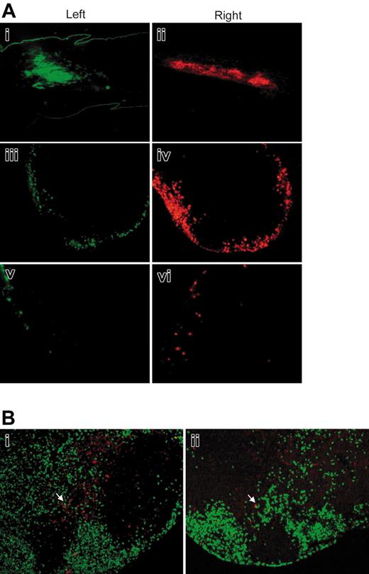 Figure 7. Fluorescent-labeled neutrophils accumulate in the ipsilateral ADLNs and reach the paracortical region. (A) Bone marrow neutrophils were labeled with CFSE (green) or PKH26 (red) and injected inside the left or right ear dorsum concomitantly with 106 CFUs of wild-type BCG (i-ii). Four hours later, green neutrophils were detected only in the left ADLNs and red neutrophils in the right ADLNs (iii-iv). In 3 independent experiments analyzed, no mixed green and red neutrophils were ever observed. Control mock-injection induced only moderate infiltration of fluorescent neutrophils in the regional ADLNs (i-ii). (B) At 12 hours after injection, Ly-6G+ neutrophils (green) were detected inside the T-cell (CD4+ and CD8+ in red) area of the ADLNs (i). CD11c+(red) DCs were also detected in the same zone and contacts between neutrophils and DCs could be observed (ii, arrows). Images were acquired as in Figure 3B.