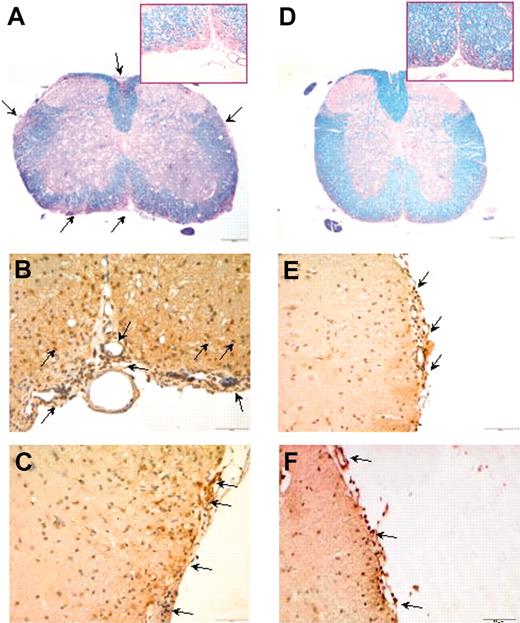 Figure 4. Pathologic findings in the CNS of C57BL/6J mice immunized with MOG35-55. Control mice are shown in panels A-C, while animals treated at 3 and 8 days after immunization are shown in panels D-F. LFB staining of the spinal cord shows areas of demyelination (arrows) in control mice compared with MSC-treated mice (D) (4 ×). CD3+ T cells (B) and macrophages (C) infiltrating the spinal cord close to leptomeningeal vessels of control mice are shown (10 ×). Limited CD3+ T cells (E) and macrophages (F) are observed in the spinal cord from MSC-treated mice. Control mice were immunized with MOG35-55 and treated with intravenous PBS alone. Arrows indicate representative histological abnormalities.