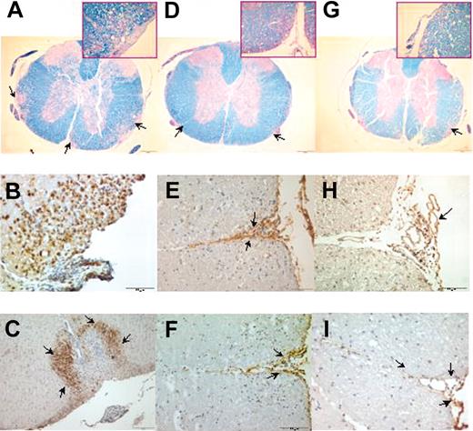 Figure 5. Pathologic findings in the CNS of C57BL/6J mice immunized with MOG35-55. Control mice are shown in panels A-C, while animals treated at 10 days after immunization are shown in panels D-F and at 15 days after immunization are shown in panels G-I. LFB staining of spinal cord shows large areas of demyelination in the control mice (A) but only scattered foci in the MSC-treated mice (D,G) (4 ×). CD3+ T cells (B, 20 ×) and macrophages (C) infiltrate the subpial layer of the spinal cord of control mice (10 ×). In contrast, only few T cells (E,H) and macrophages (F,I) are detected in the spinal cord from MSC-treated mice (all 10 ×). Control mice were immunized with MOG35-55 and treated with intravenous PBS alone. Arrows indicate representative histological abnormalities.