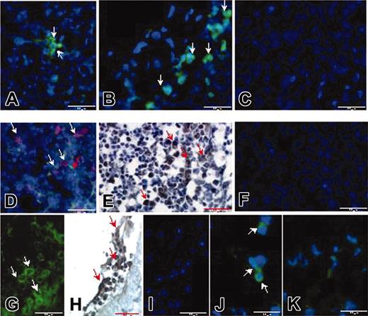 Figure 7. MSCs home to lymphoid organs and the subarachnoid spaces. eGFP+ mMSCs are detected, at day 9 after immunization, in the spleen of treated mice by immunofluorescence as shown in panels A-B (20 ×) and, at day 40 after immunization, as detected by immunohistochemistry (brown, E) (20 ×). eGFP+ mMSCs are observed next to T cells as revealed by triple staining for CD3 (red), DAPI (blue), and eGFP+ (green) in the spleen of treated animals (D) (20 ×). eGFP+ mMSCs are detected also in the subarachnoid spaces of the spinal cord of MSC-treated mice by immunofluorescence (G) and immunohistochemistry (H). Scattered eGFP+ cells are observed by immunofluorescence inside the parenchyma just beneath the subpial layer of treated mice (J) (40 ×). Negative controls are shown in panels C, F, I, and K. Arrows indicate MSCs.