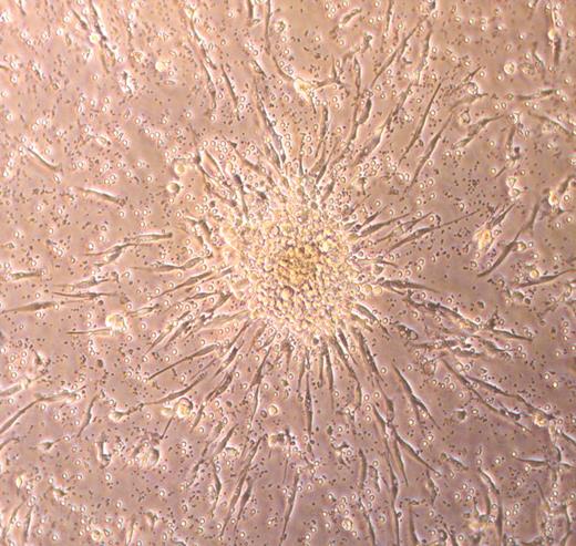 Figure 1. Photomicrograph of a typical endothelial cell colony-forming unit (CFU-EC) that is counted as an EPC.34 The cluster of round cells sits on top of spindle-shaped adherent cells that emigrate from the base of the cell cluster. Over time, the cluster of cells disappears, leaving the adherent spindle-shaped cells that display features of endothelial cells. Phase-contrast image was collected using a Zeiss Axiovert 2 inverted microscope (Carl Zeiss, Thornwood, NY) with a 5 × CP-ACHROMAT/0.12 NA objective. Image was captured with a SPOT RT color camera (Diagnostic, Sterling Heights, MI).