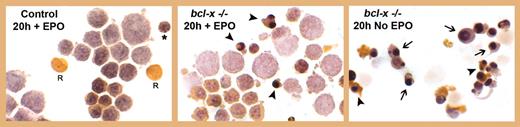 Morphologic appearance of cultured bcl-x–/– and bled control erythroblasts. See the complete figure in the article beginning on page 1857.