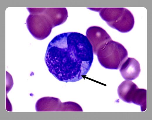 Peter Maslak, Memorial Sloan-Kettering Cancer Center