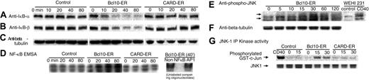 Figure 4. Rapid activation of the NF-κB and JNK pathways by Bcl10 but not by its CARD. (A-D) NF-κB activation. Bcl10-ER or Bcl10 CARD-ER-expressing cells or a nonexpressor control clone were treated with E2 (1 μM) for indicated periods of time (minute) and directly lysed with sodium dodecyl sulfate (SDS) sample buffer. Lysates were blotted with anti-IκB-α (A) and, after stripping, with anti-IκB-β (B) to detect degradation of IκB-α or IκB-β. To control for sample loading, identical gels were blotted with anti-β-tubulin (C). (D) Indicated cells were treated with E2 (1 μM) to activate Bcl10 or Bcl10 CARD. Nuclear lysates were prepared and electrophoretic mobility shift assay (EMSA) performed with a 32P-labeled oligonucleotide consensus sequence for NF-κB binding. (Right) The specificity of the assay was verified in a repeat experiment in which competing nonlabeled NF-κB- or activator protein 1 (AP1)-binding oligonucleotides (the latter being a negative control) were included in 25-fold molar excess during the binding. (E-G) JNK activation by Bcl10 but not its CARD domain. Indicated cells were treated with E2 (1 μM) and analyzed for JNK activation by blotting the lysates with an antibody specific for phosphorylated JNKs (arrows) (E). CD40-stimulated (15 minutes) WEHI-231 cells were used as a positive control. To verify equal loading of samples, an identical gel was blotted with anti-β-tubulin (F). (G) Cells were treated with E2 (1 μM) and lysed. JNK1 was immunoprecipitated from the lysates and measured for its in vitro kinase activity using purified glutathione S transferase (GST)-c-Jun (N-terminus) as the substrate. CD40-stimulated (15 minutes) nonexpressor cells were used as a positive control for the kinase assay. The kinase reactions, once no longer radioactive, were blotted with anti-JNK1 to confirm comparable levels of immunoprecipitated JNK1 protein in the reactions (bottom).