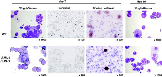 Figure 4. Morphology of dysplastic mixed-like hematopoietic colonies in the AML1/EVI1/+ fetal liver culture. On days 7 and 10 of culture, cytocentrifuge preparations of cells from mixed-like colonies were stained with Wright-Giemsa for morphologic examination (OL, 100 ×/1.40; OM, × 1000), benzidine for the presence of erythroblasts (OL, 10 ×/0.30; OM, × 100), or choline esterase for the presence of megakaryocytes (OL, 60 ×/1.40; OM, × 600). AML1/EVI1/+ mixed-like colonies in the bottom panels show retarded maturation and hypogranulation of myeloid cells as well as the absence of erythroid cells. In contrast, WT mixed colonies in the top panels show normal trilineage differentiation.